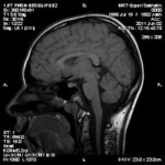 sagittal.jpg