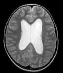 ventricles2.jpg