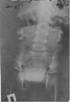 x-ray_25_1.jpg