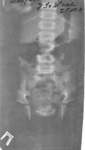 x-ray_90_1.jpg