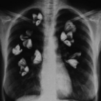 X_RAY_022 аватар