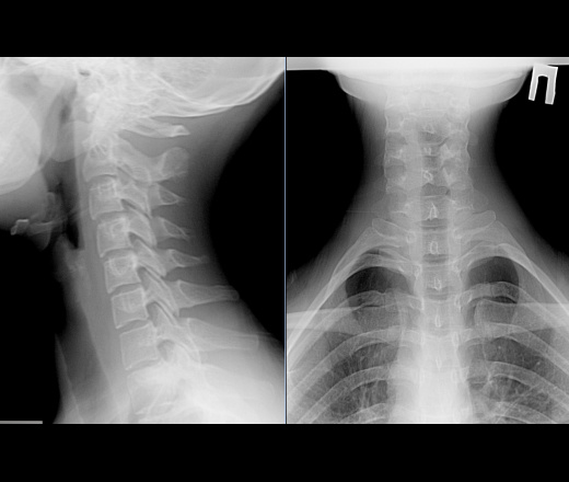 КТ позвоночника – цена в Казани, сделать компьютерную томографию спины в клинике «Будь Здоров»