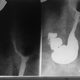 Рентген с барием пищевода и желудка подготовка. Атония желудка рентген. Грыжа пищевода рентген с барием. Дефект наполнения желудка рентген.