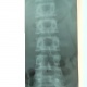 Рентген позвоночника лежа или стоя