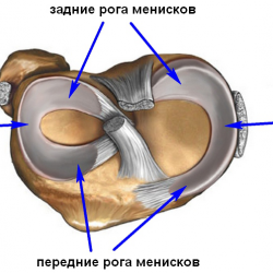 Межмыщелковые бугорки заострены что это. Смотреть фото Межмыщелковые бугорки заострены что это. Смотреть картинку Межмыщелковые бугорки заострены что это. Картинка про Межмыщелковые бугорки заострены что это. Фото Межмыщелковые бугорки заострены что это