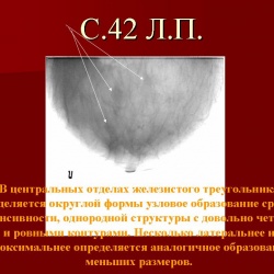 изображение с сайта www.radiomed.ru