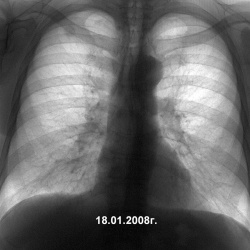 изображение с сайта www.radiomed.ru