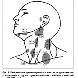 Лимфоузлы на шее классификация