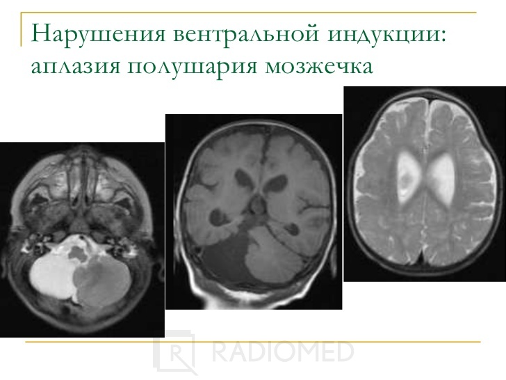 Кт в неврологии презентация