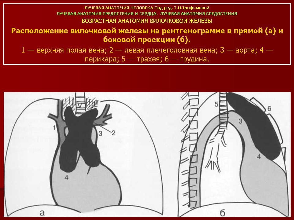 Рисунки верхней полой. Анатомия средостения рентген. Средостение ретнгенанатомия. Верхняя полая Вена на рентгенограмме. Верхняя полая Вена рентген анатомия.