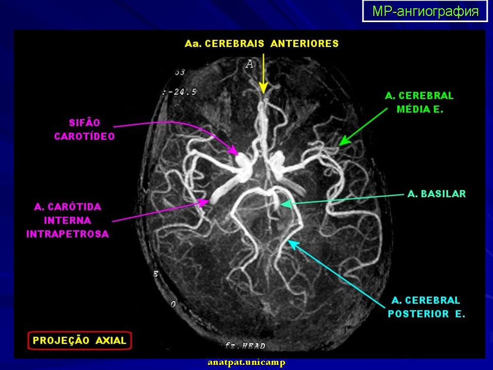 Сосуды головного мозга норма. Ангиография сосудов головного мозга анатомия. Анатомия сосудов мозга мрт. Кт ангиография аневризма головного мозга. Кт ангиография сосудов головного мозга анатомия.