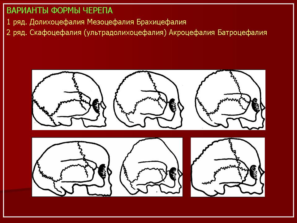 Варианты формы черепа. Долихоцефалия черепа плода. Патологические формы черепа. Форма черепа в норме и при патологии.