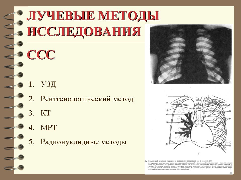 Лучевые методы. Метод рентген исследование ССС. Лучевые методы исследования сердечно-сосудистой системы. Рентгенологическое исследование сердечно сосудистой системы. Рентгенологические методы исследования сердечно-сосудистой системы.