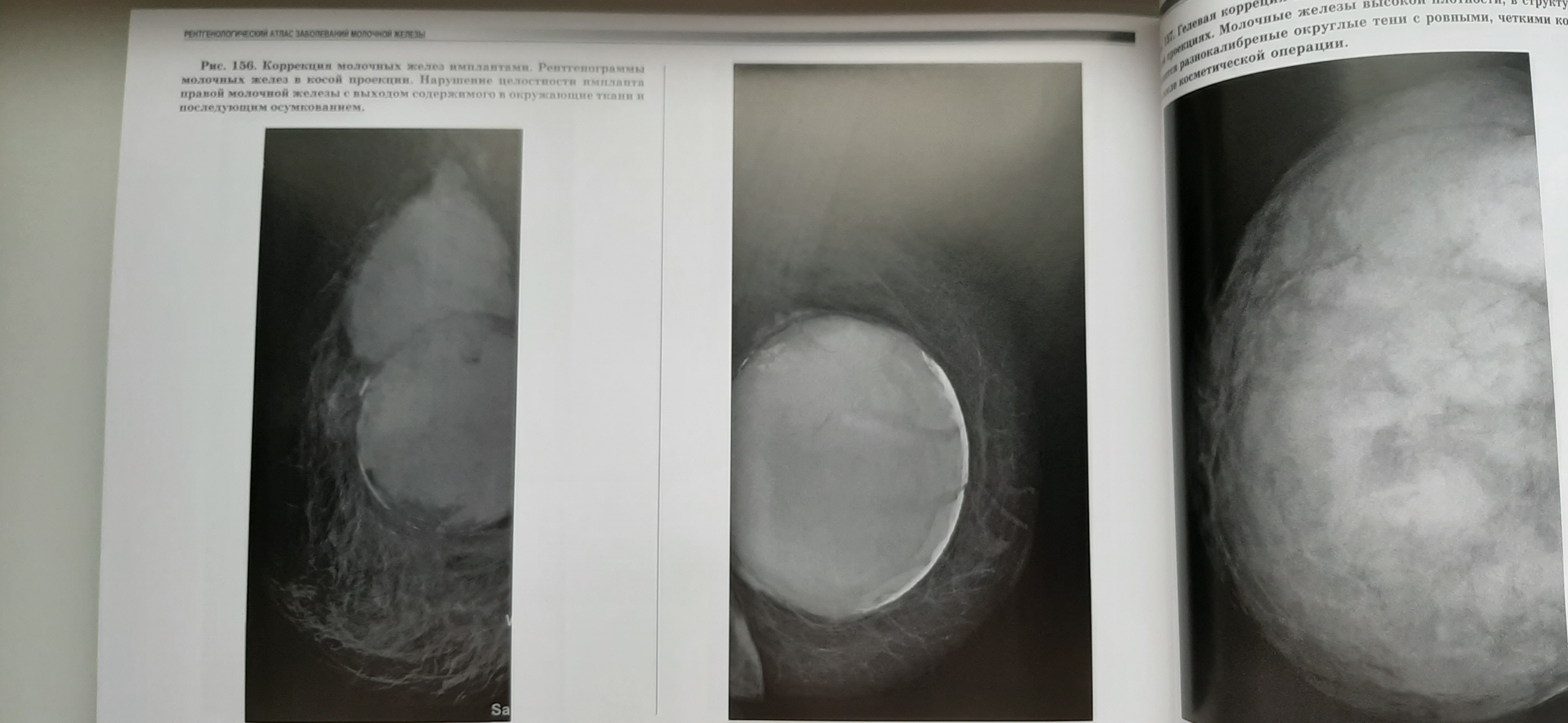 Рентгенологический атлас заболеваний молочной железы САМГМУ