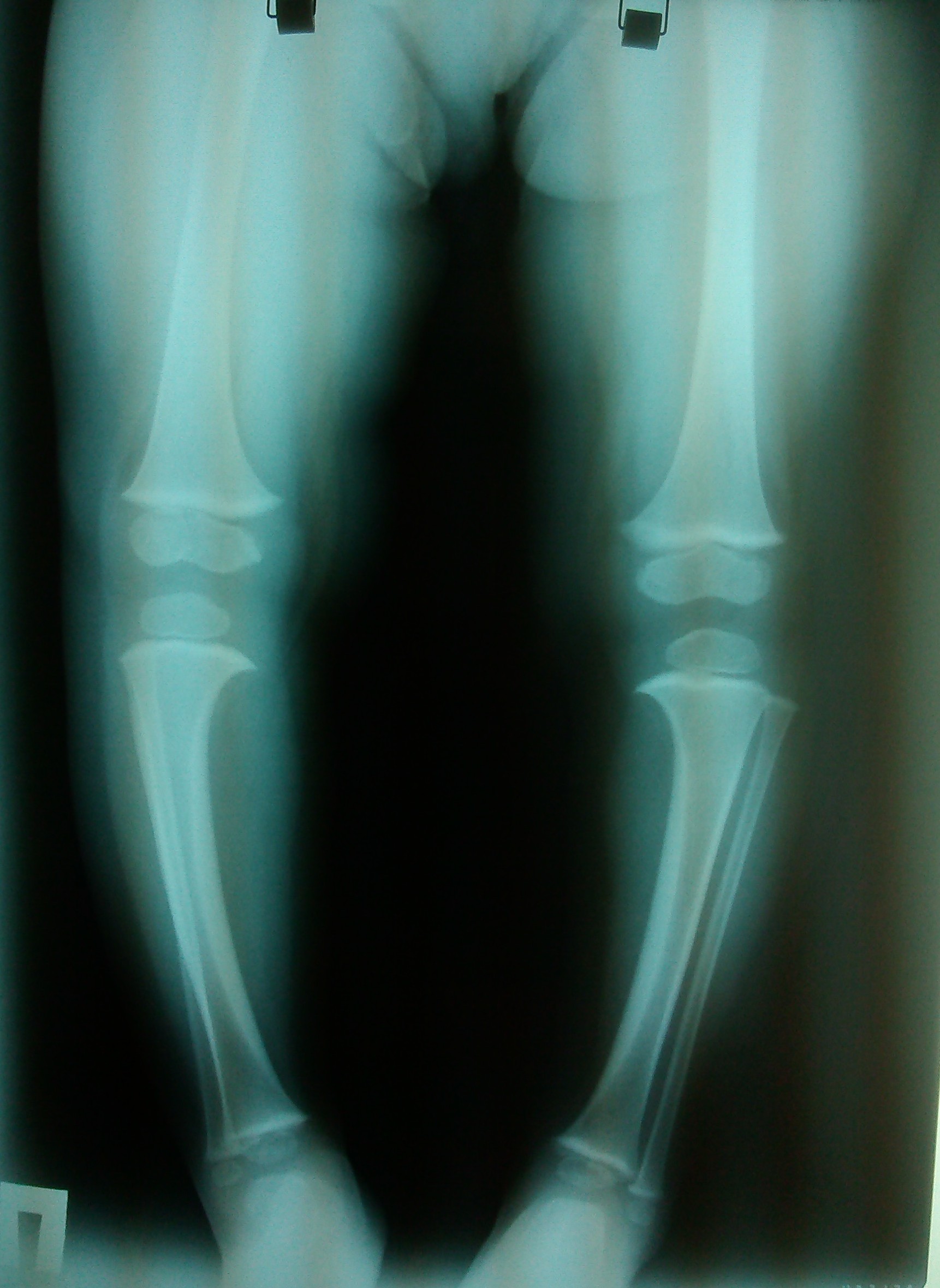 Фото рентгена ноги