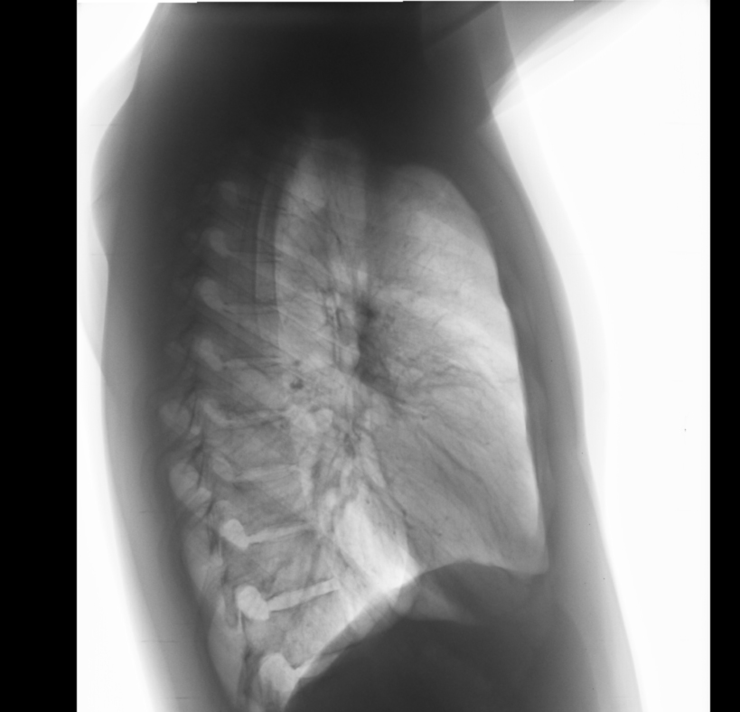 Рентгенограмма в боковой проекции. Рентген в боковой проекции норма. Пневмония боковая проекция проекция рентген. Рентген легких боковая проекция норма.