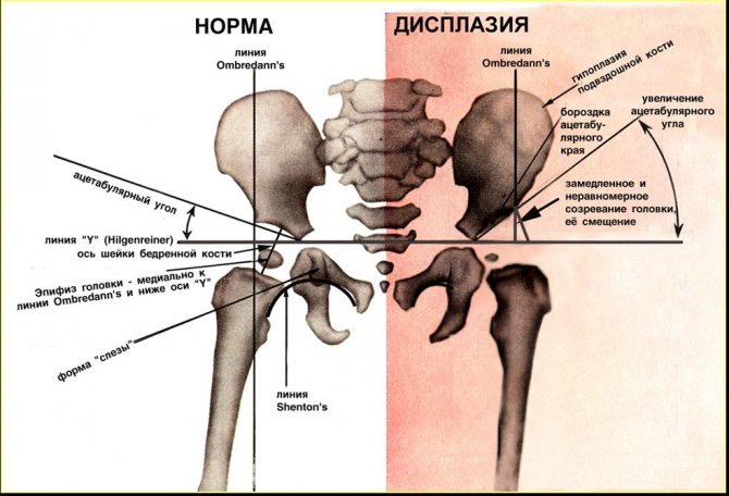 Карта тбс банка