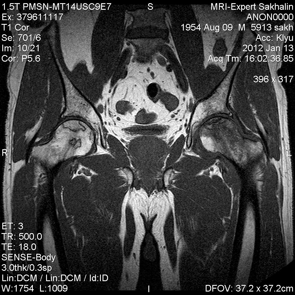 Как делают мрт тазобедренного сустава взрослым фото