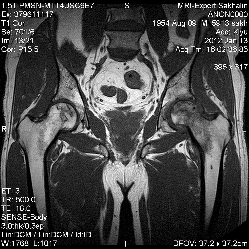 Как делают мрт тазобедренного сустава женщин фото